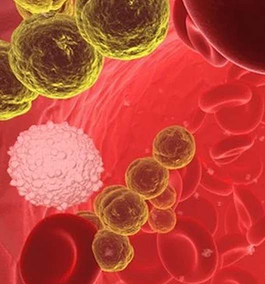 Sepsis scope image - Enhanced